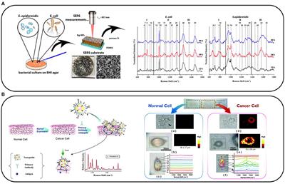 Applications of Surface-Enhanced Raman Scattering in Biochemical and Medical Analysis